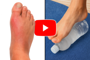 Neuropathy treatment video thumbnail